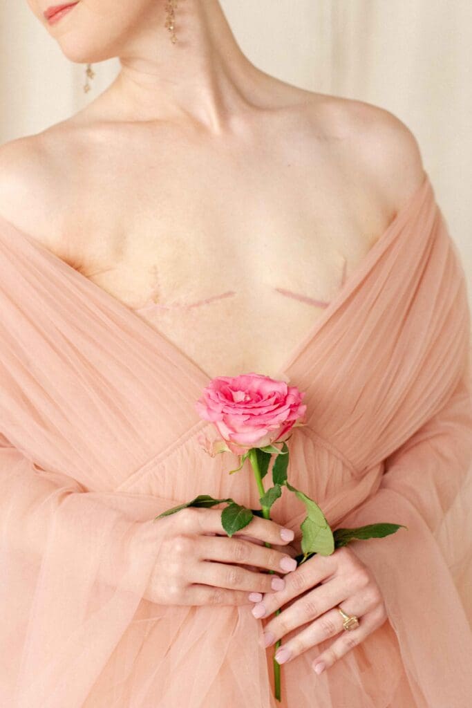 breast cancer survivor scars